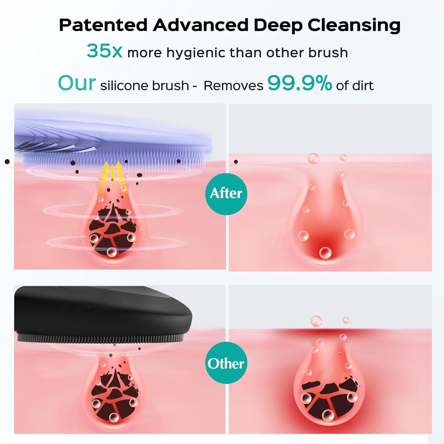 COSLUS brush-top silicone bristles provide gentle yet thorough pore cleansing