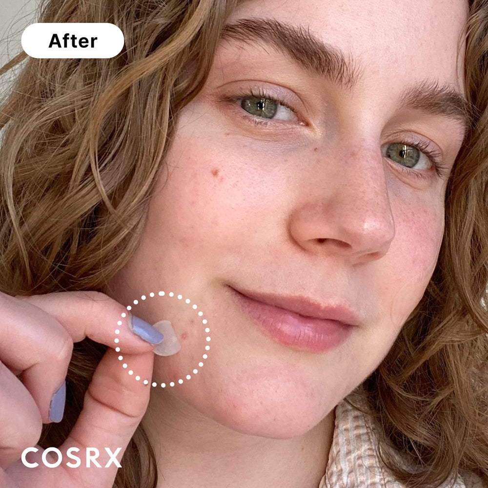 COSRX Acne Pimple Patch absorption closeup reveals hydrocolloid layer absorbing fluids.