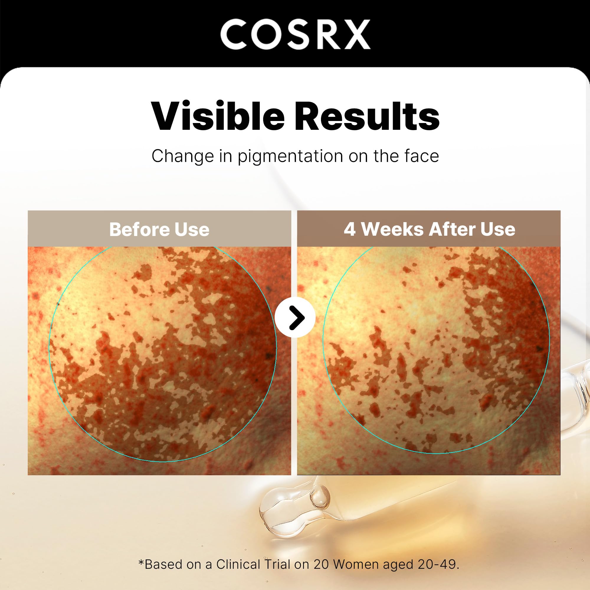 COSRX serum pump design enables precise dispensing for targeted application.