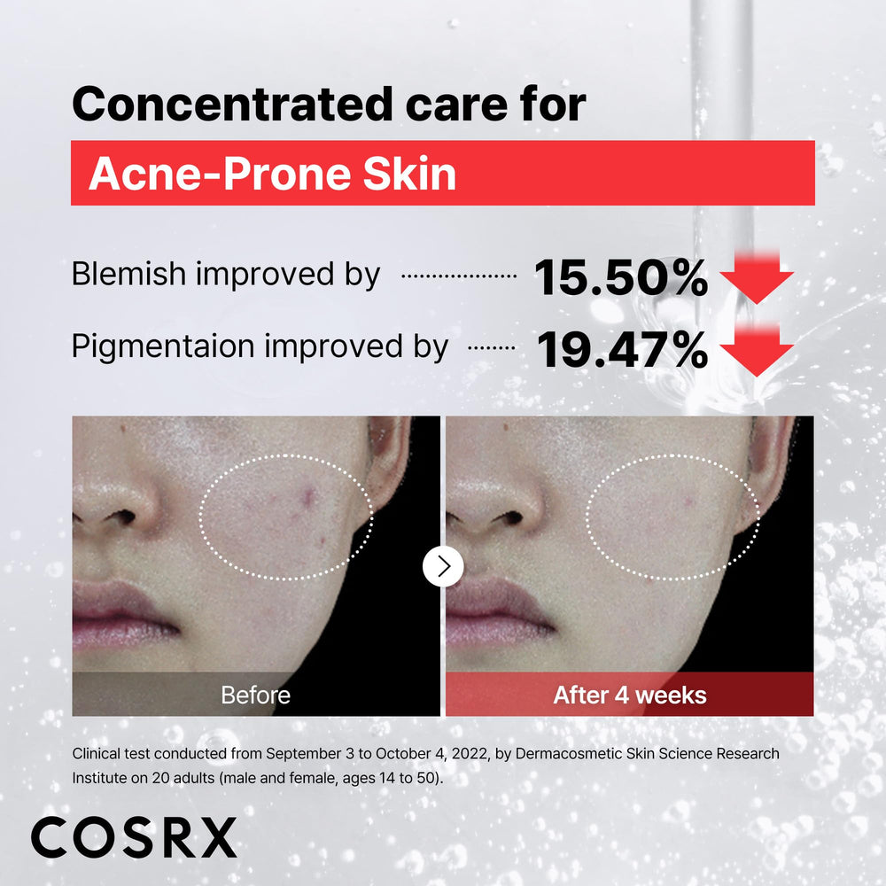 Serum shown with SPF in a daytime routine for balanced skin