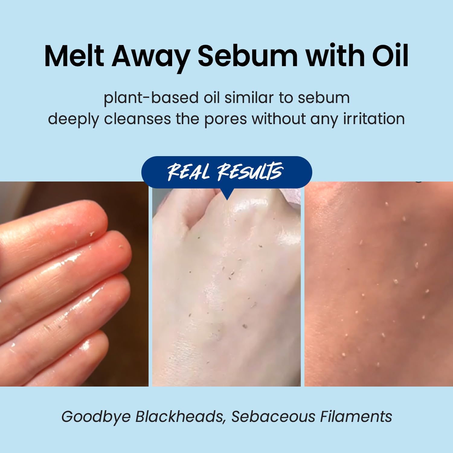Coxir Ultra Hyaluronic Cleansing Oil dissolves sunscreen and heavy makeup gently.