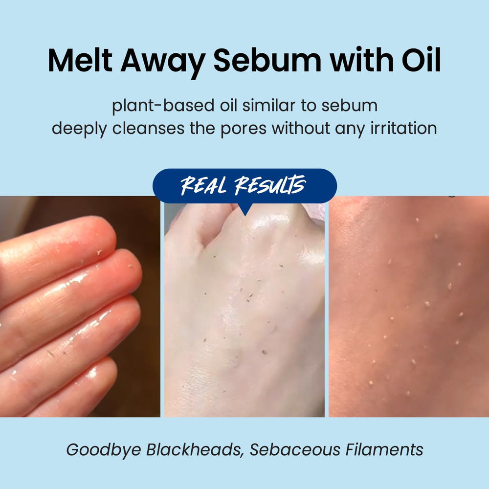 Coxir Ultra Hyaluronic Cleansing Oil dissolves sunscreen and heavy makeup gently.