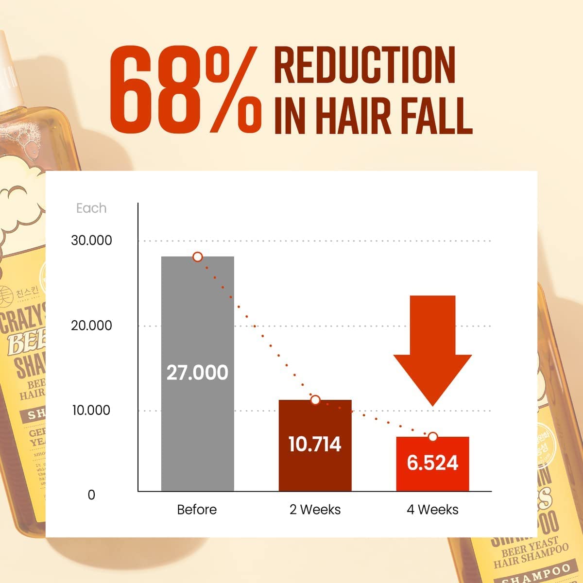 CRAZY SKIN dandruff-control action image hints reduced flakes and scalp refreshment
