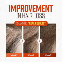 CRAZY SKIN Beers Yeast Shampoo lather delivers refreshing cleanse for scalp comfort