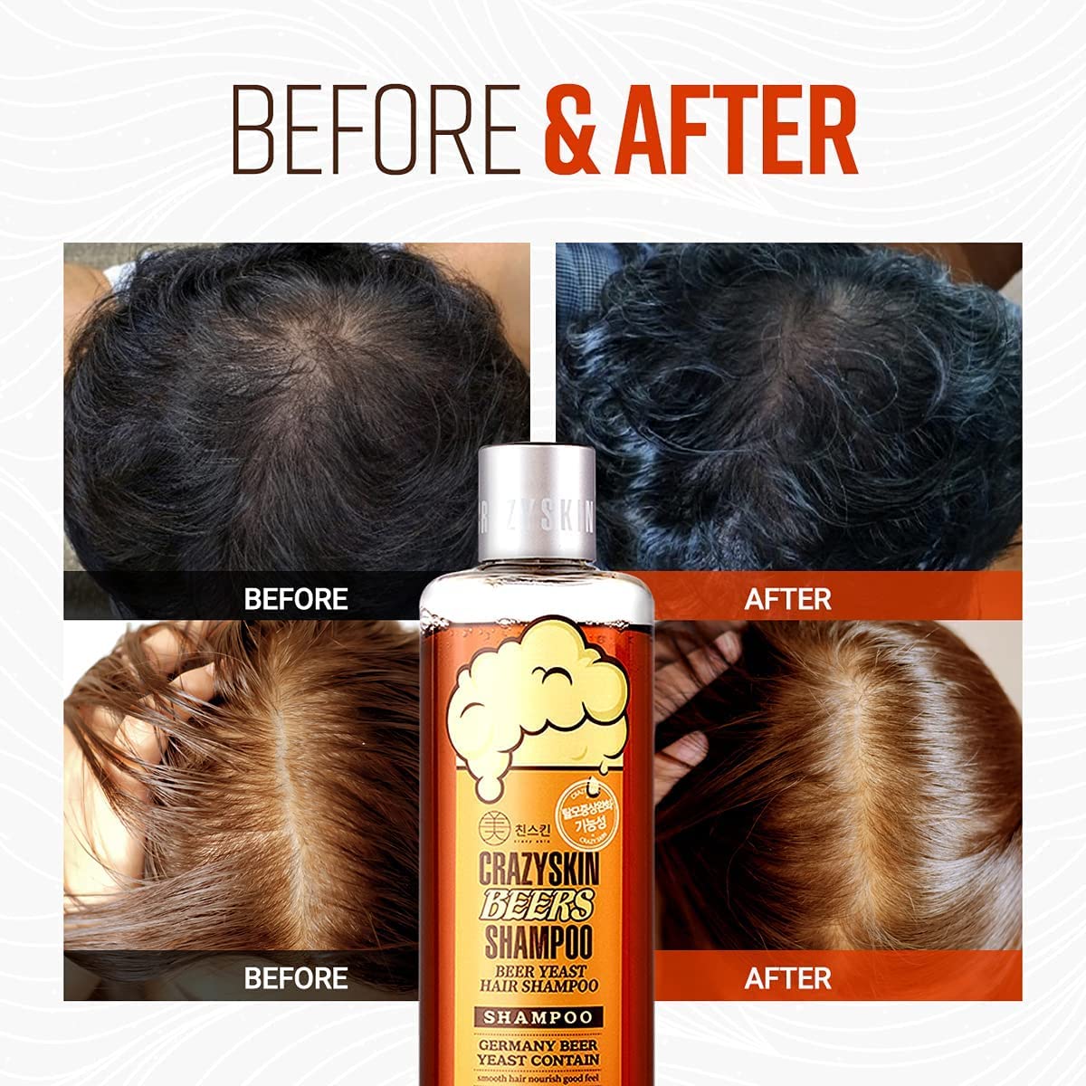 Crazy Skin German Beers Shampoo ingredients reveal beer yeast for biotin benefits