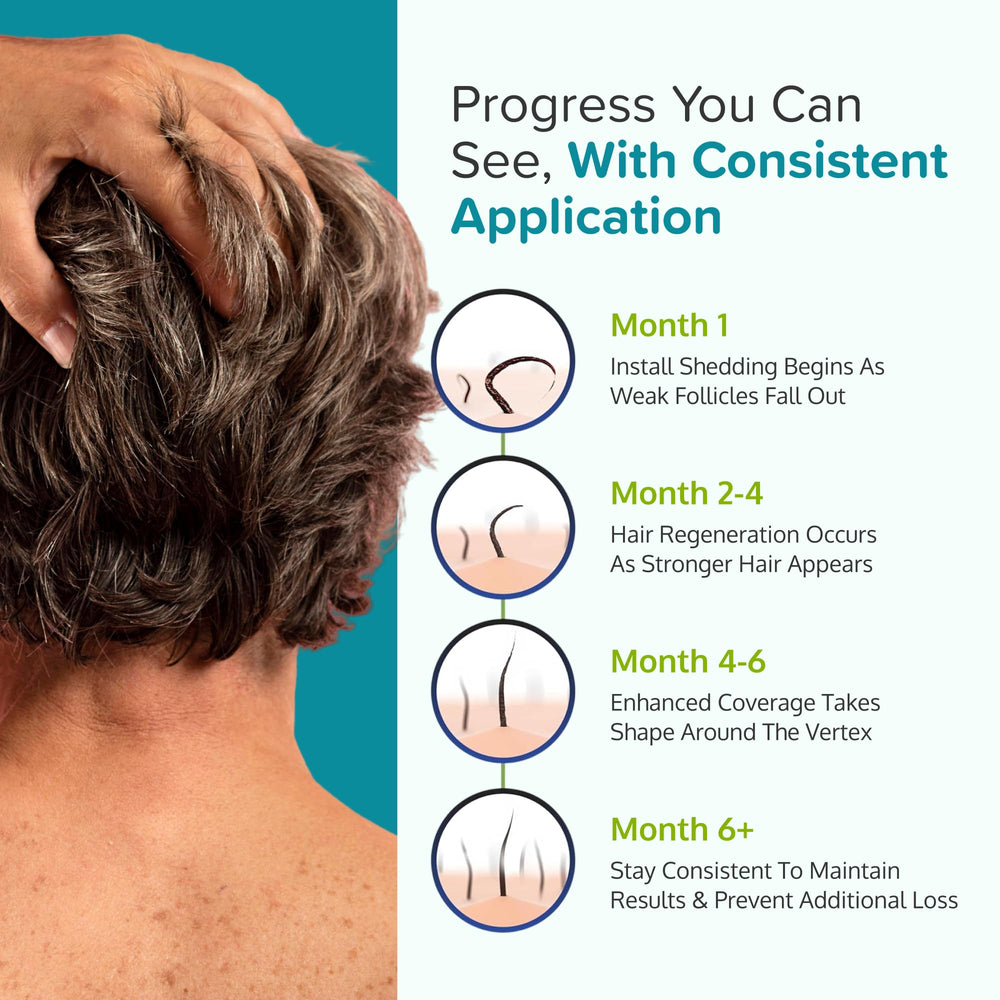 crcle minoxidil foam scalp health scene conveys a healthy scalp focus