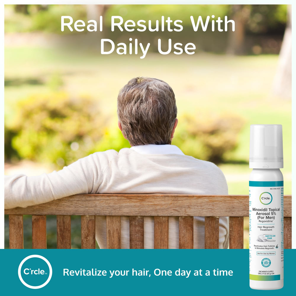 crcle minoxidil foam vertex area closeup emphasizes target thinning area and potential improvement