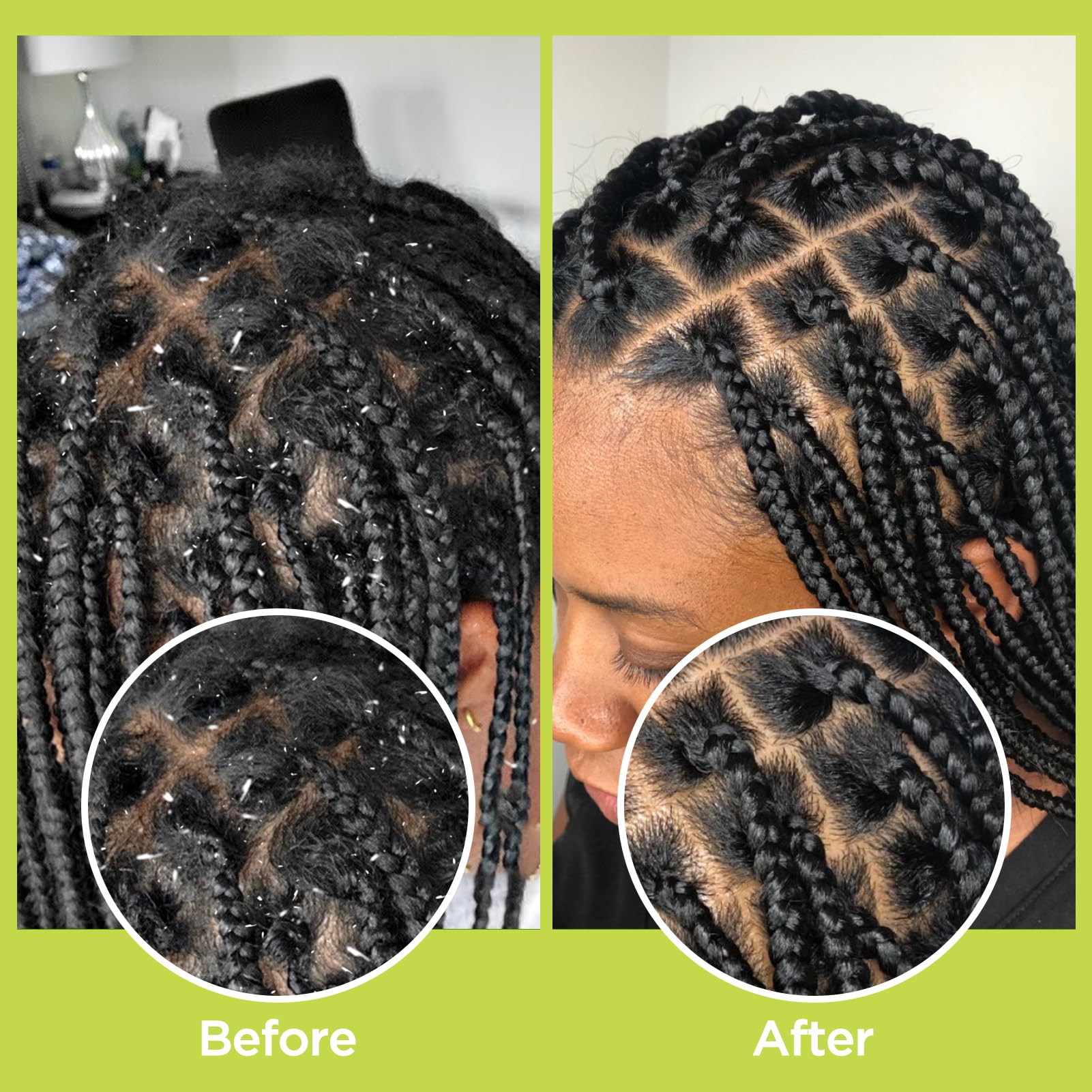 Curlland daily scalp detox setup for balanced oils