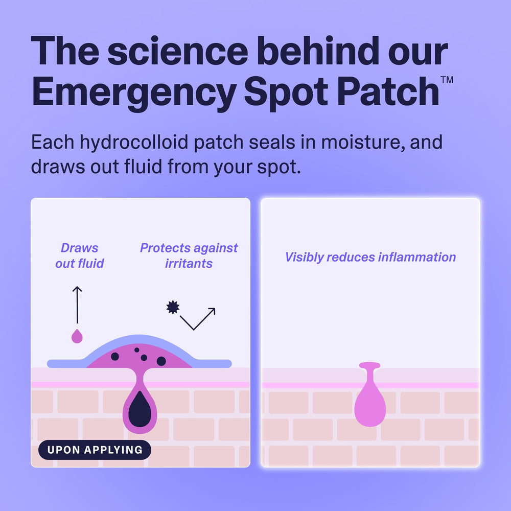 Curology Emergency Spot Patches during workout stay put and discreet.