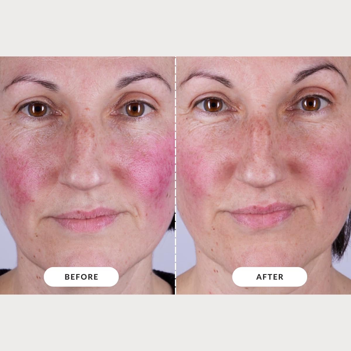 CurrentBody Skin LED Mask Series 2 glow-ready look after sessions