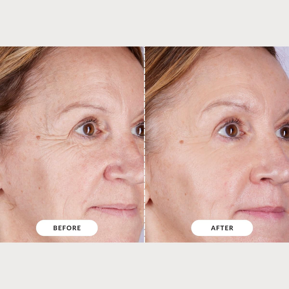 CurrentBody Skin LED Mask Series 2 Best-Fit silicone shape delivers comfortable coverage