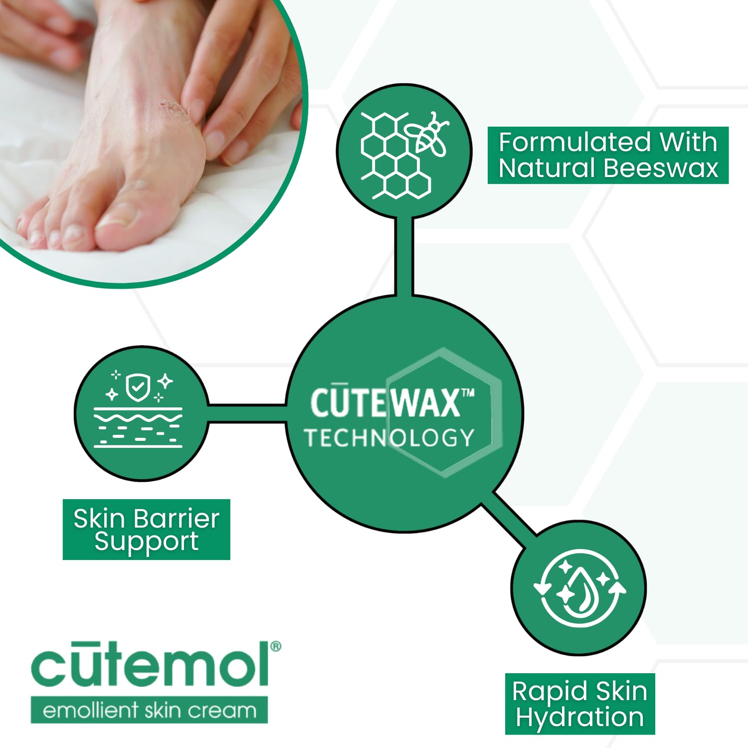Cutemol Emollient Cream feet-heel-care supports hydration for cracked feet.