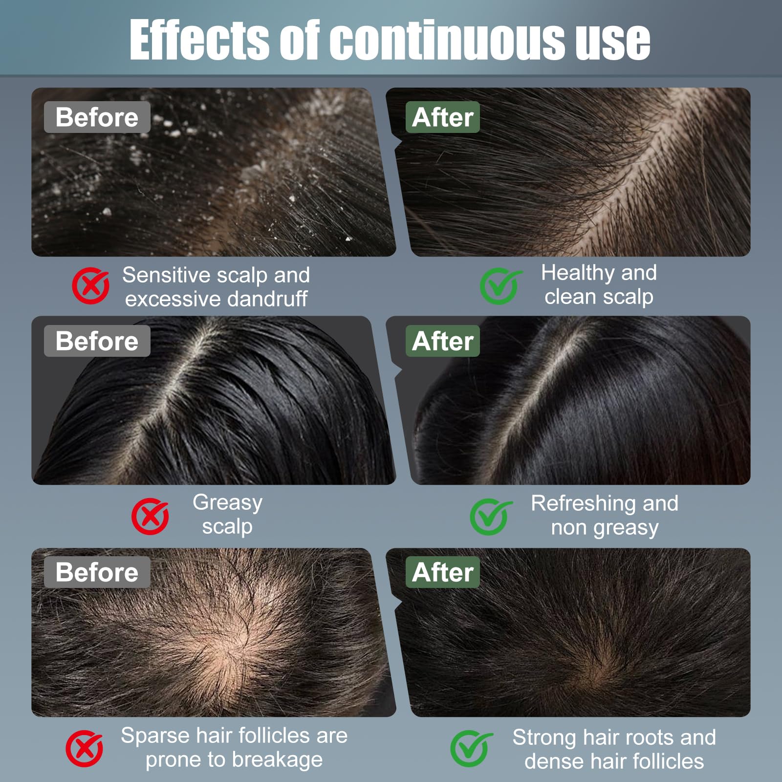 CWTUL Laser Hair Growth Comb rechargeable battery image emphasizes cordless convenience