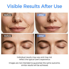 DABZAL Skin Scrubber Ion Minus mode offers gentle cleansing for sensitive skin