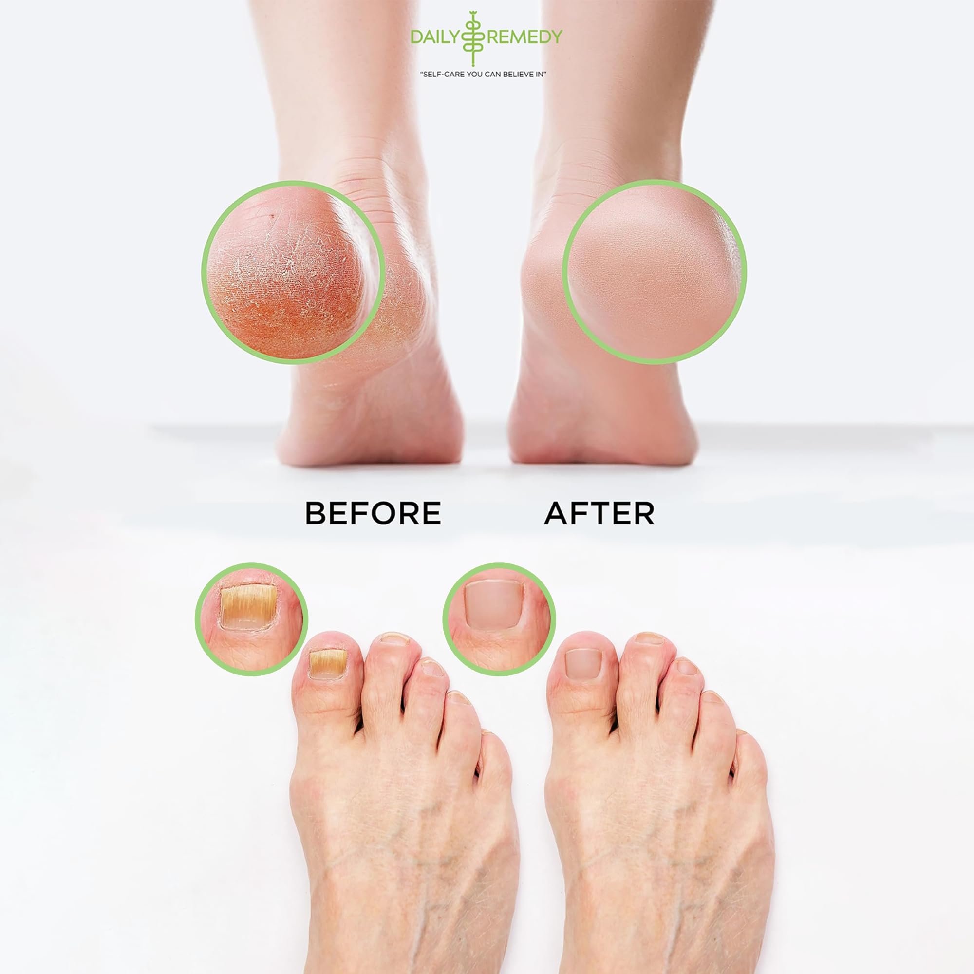 Daily Remedy Foot Soak Salts highlighting natural ingredients for skin nourishment.