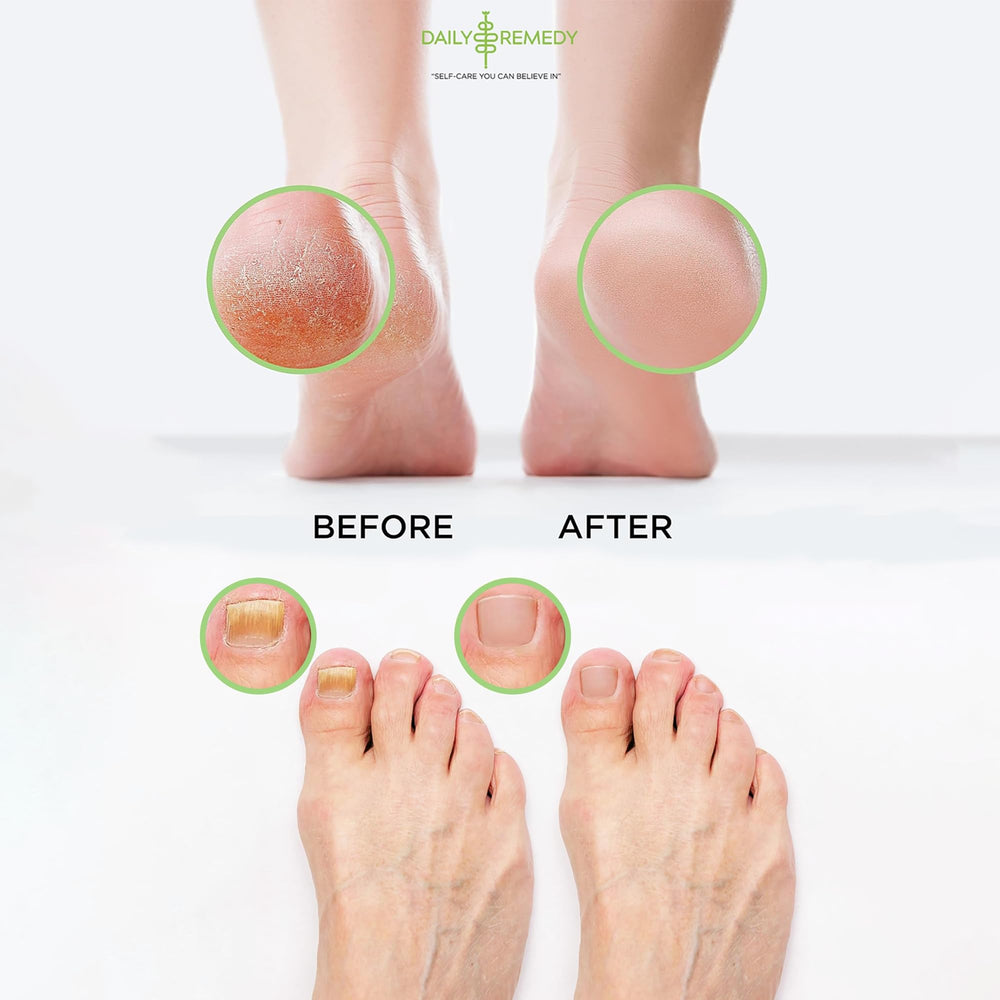 Daily Remedy Foot Soak Salts highlighting natural ingredients for skin nourishment.