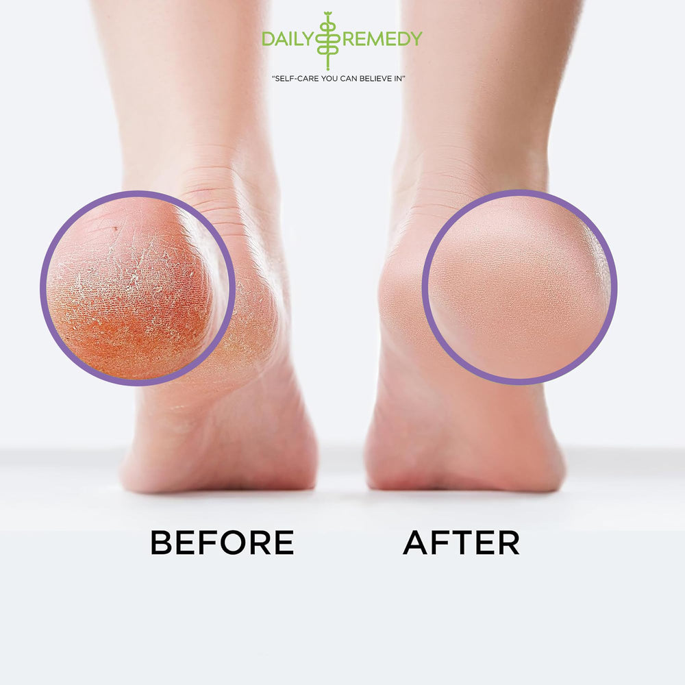 Daily Remedy Sea salt blend close-up displays natural ingredients for softer, hydrated feet.