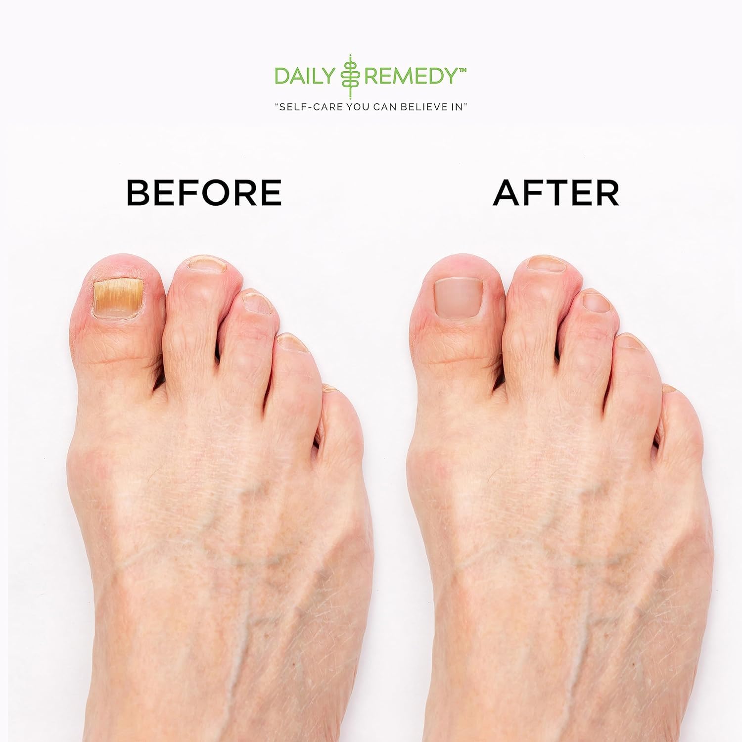 Daily Remedy pies relajados tras remojo tibio