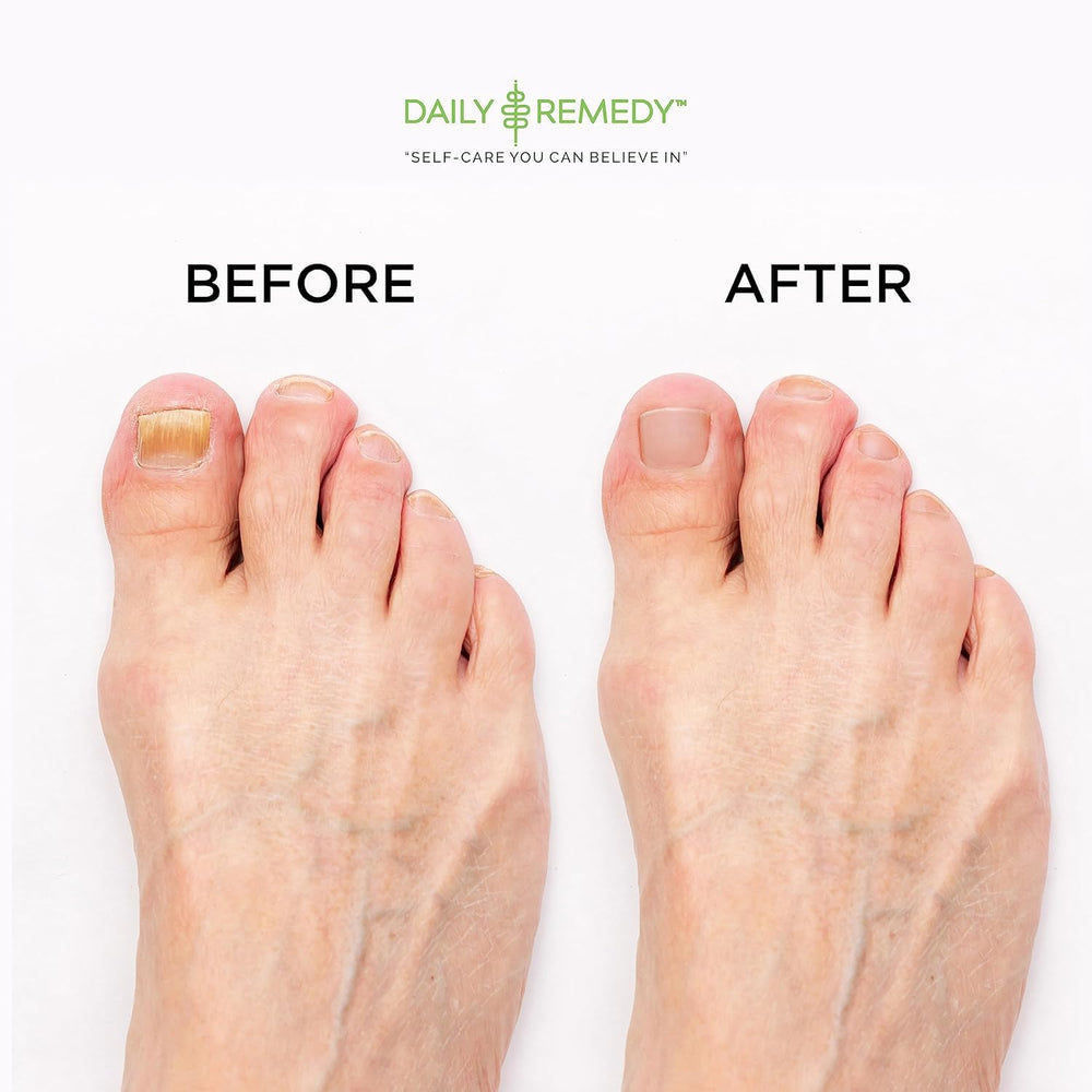 Daily Remedy pies relajados tras remojo tibio