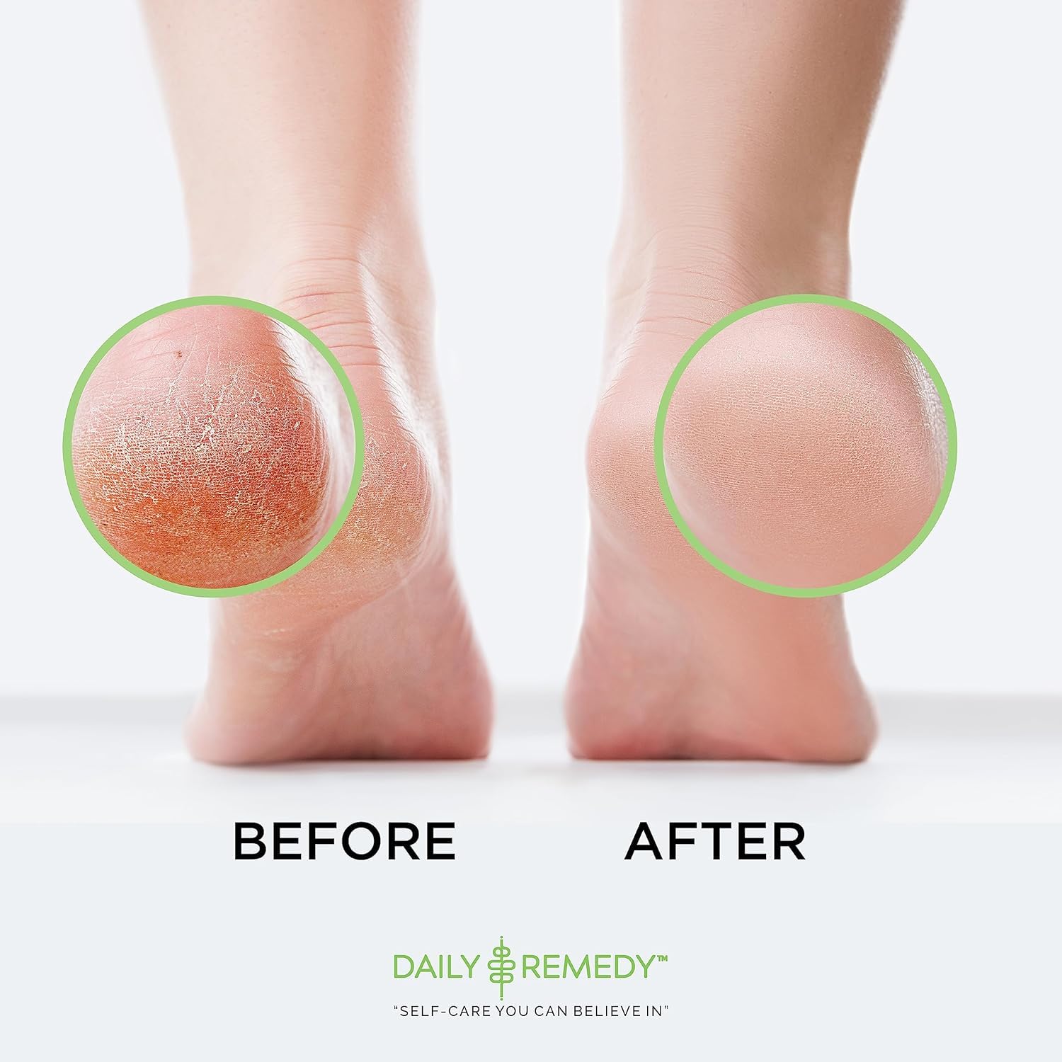 Daily Remedy tired feet relaxation ritual suggests post-workout relief