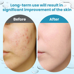 Dalin Glycolic bottle label shows 15% glycolic and 2% salicylic