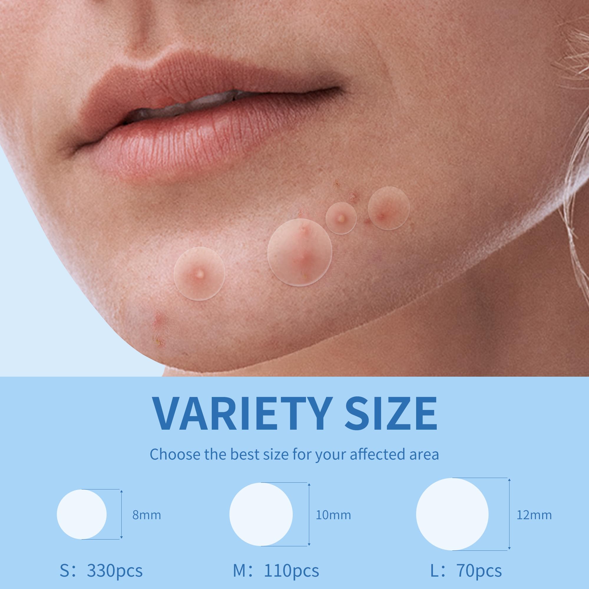 Daolyo pimple patches 12mm pack for larger spots with invisible wear.