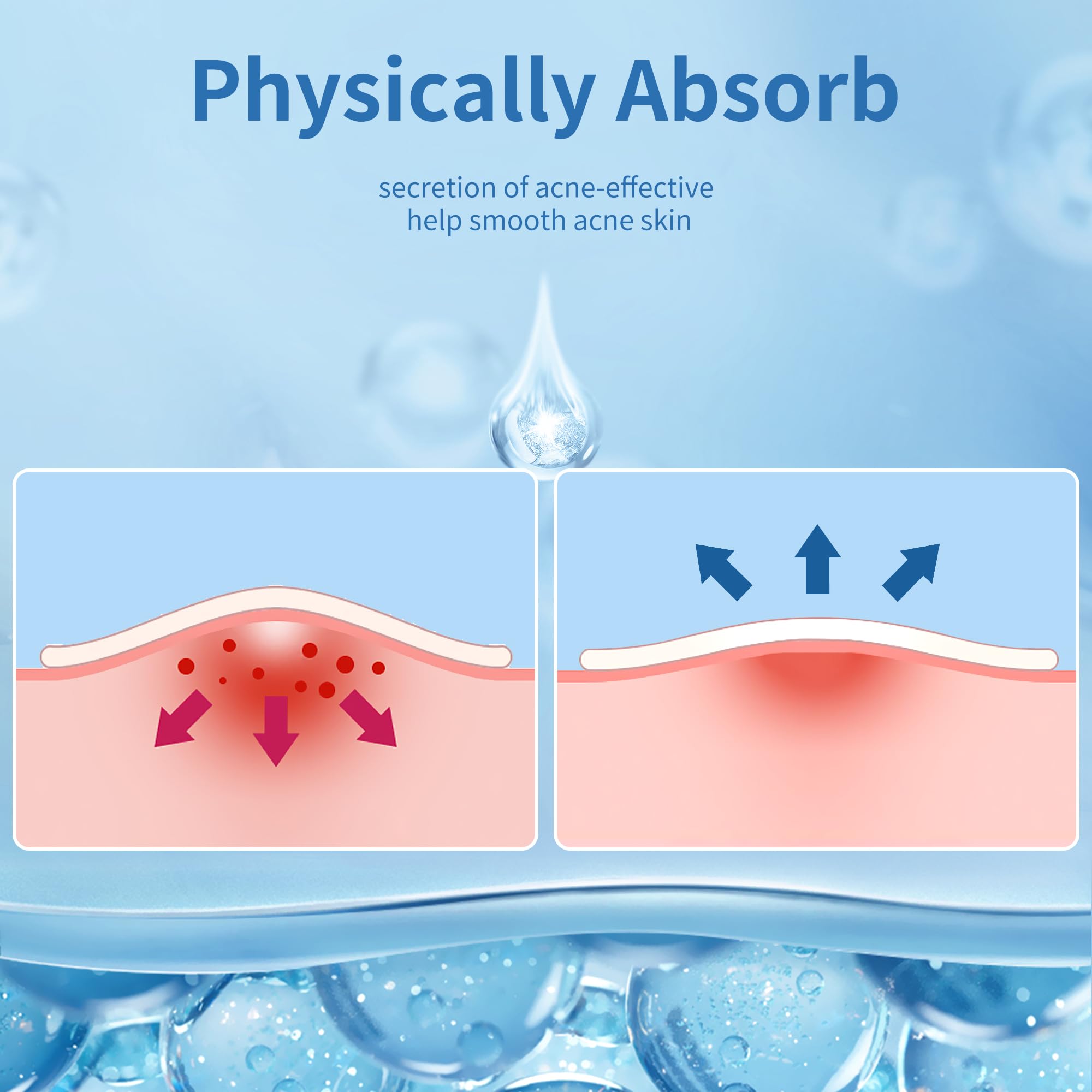 Daolyo pimple patches hydrocolloid absorbing to draw out gunk and protect skin.