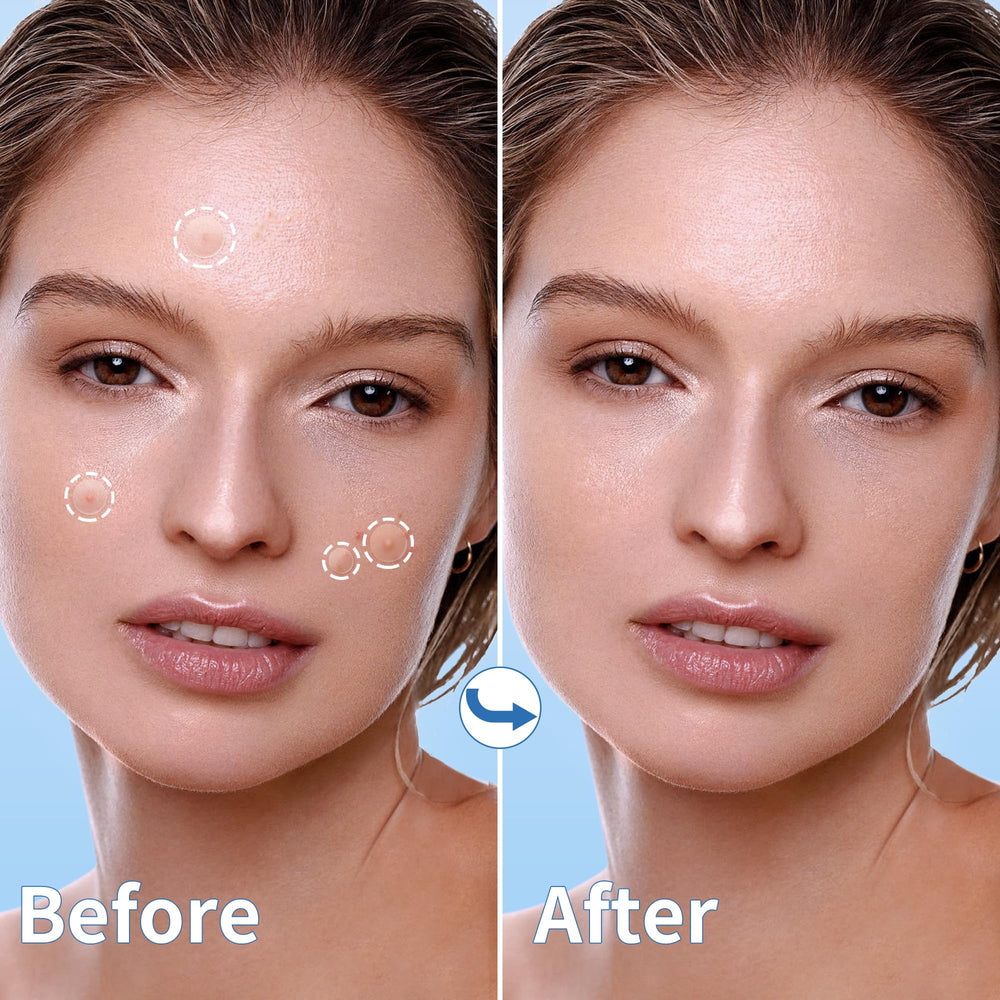 Daolyo pimple patches invisible design shows ultra-thin coverage for day wear.