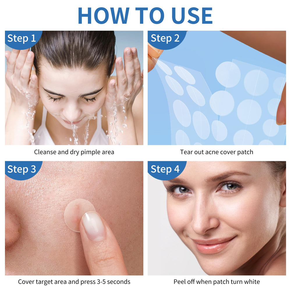 Daolyo pimple patches night-use application shows easy overnight treatment.
