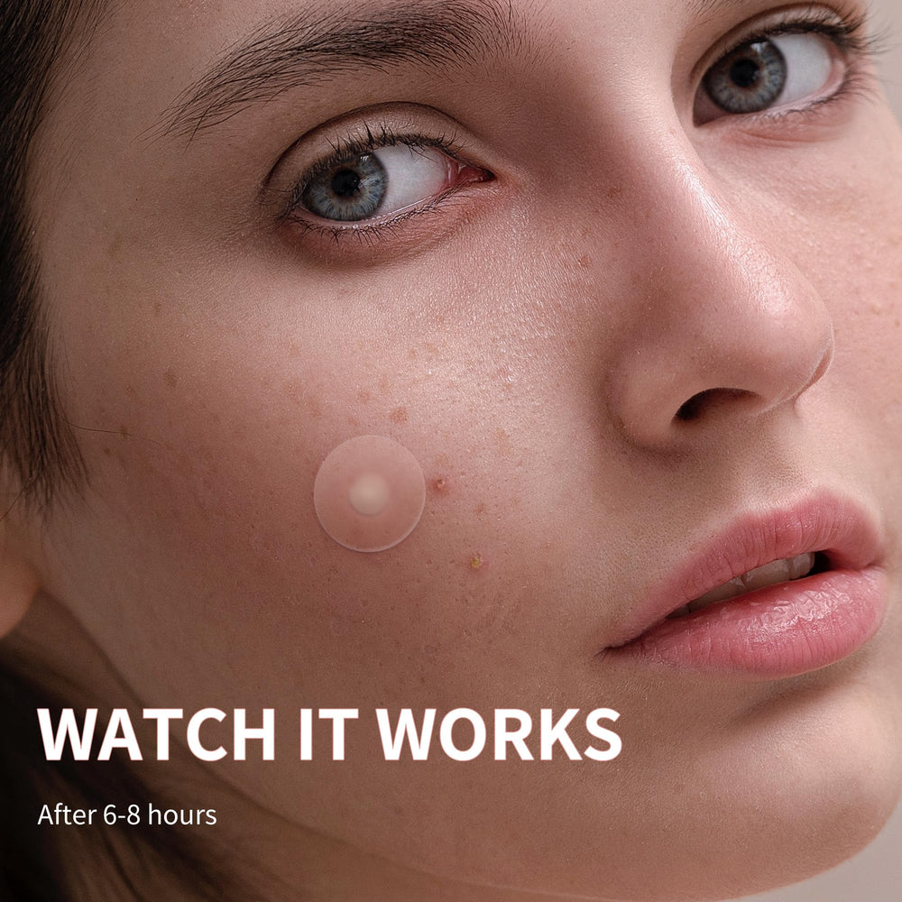 Daolyo pimple patches on-face adhesion demonstrates strong hold through night movements.