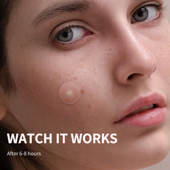 Daolyo pimple patches on-face adhesion demonstrates strong hold through night movements.