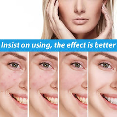 Dark Spot Face Cream spread-on skin demonstrates even coverage and hydration.