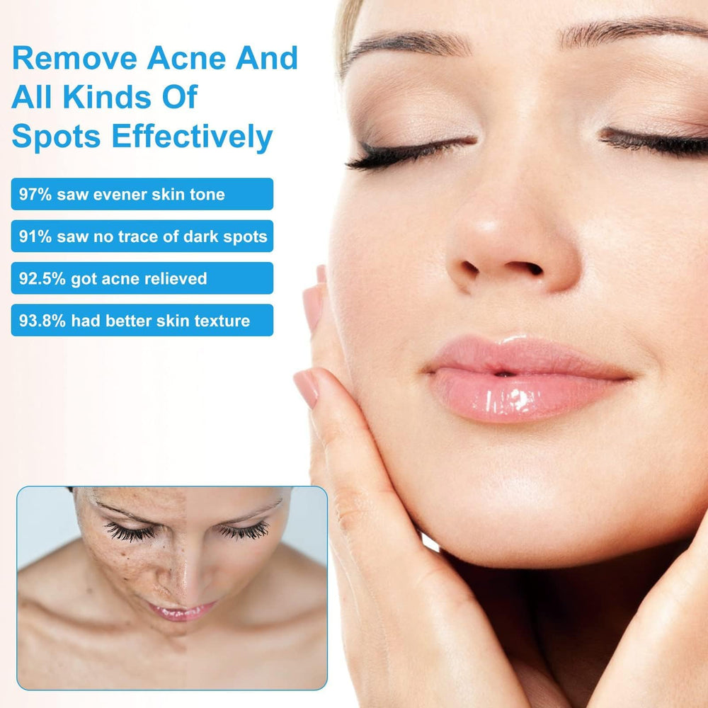 Dark Spot Face Cream 20g is travel-friendly for on-the-go skincare.