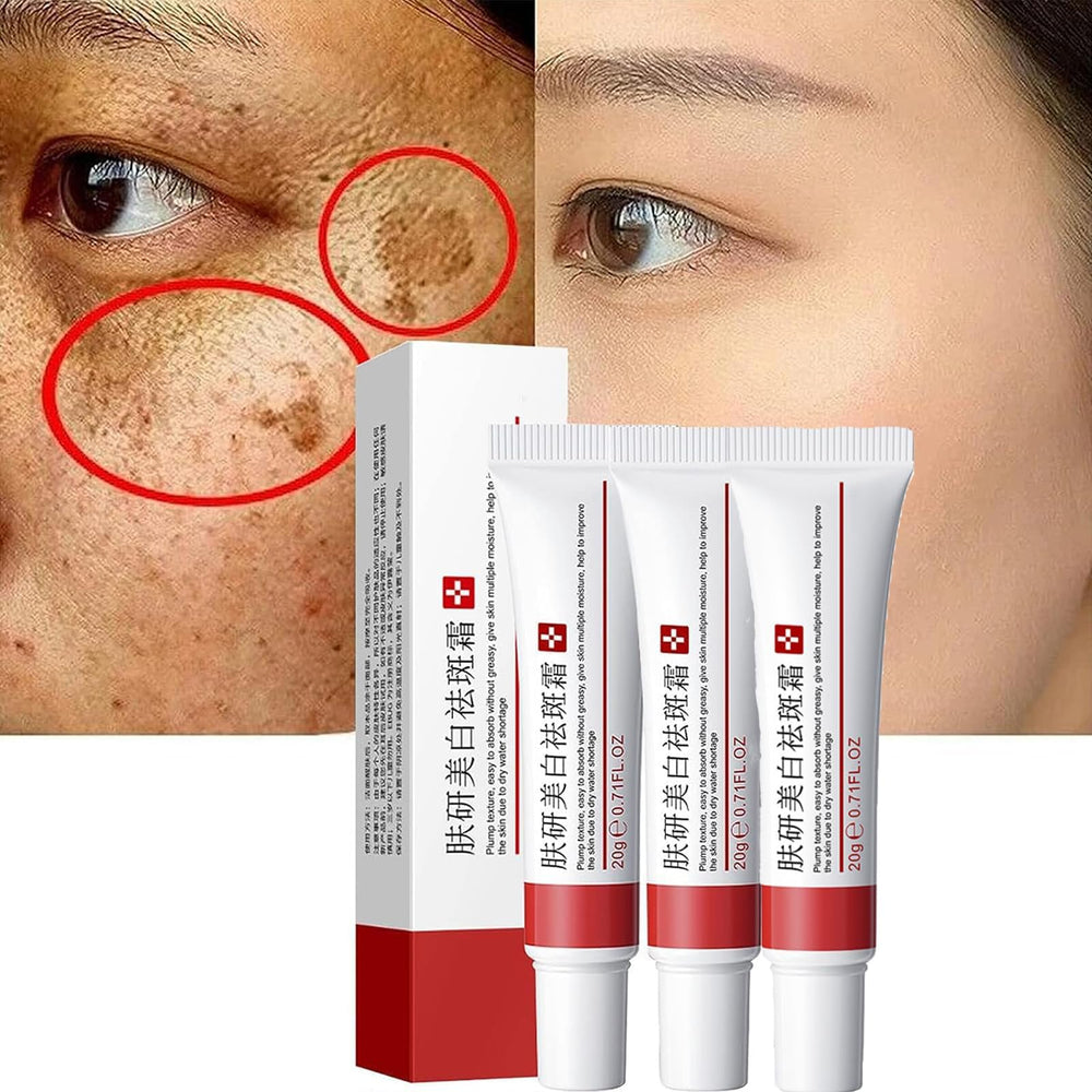 Dark Spot Face Cream tube closeup highlighting creamy texture for gentle application.