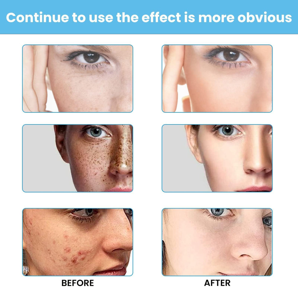Dark Spot Face Cream tube with secure cap enables precise and clean application.