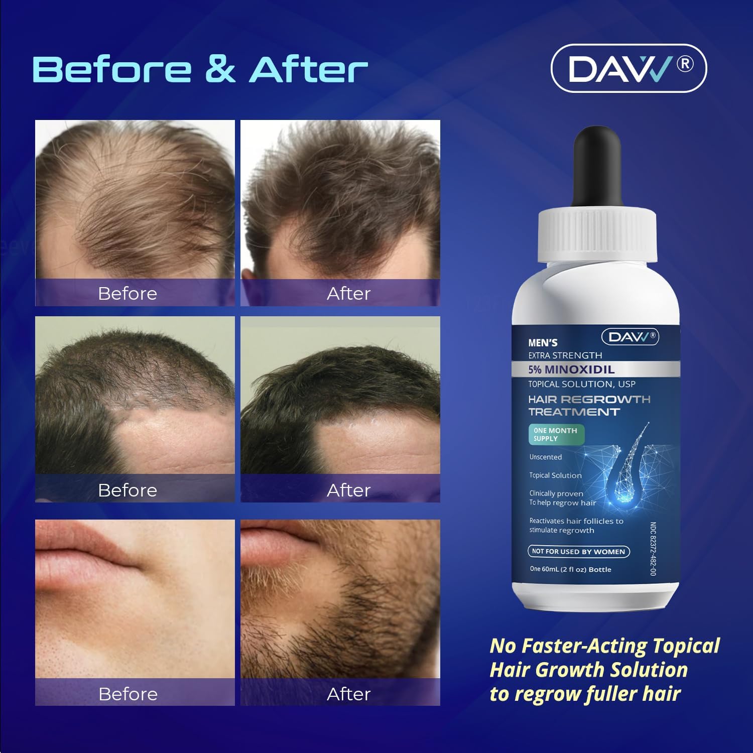 DAVV Biotin-enriched formula supports stronger hair from roots