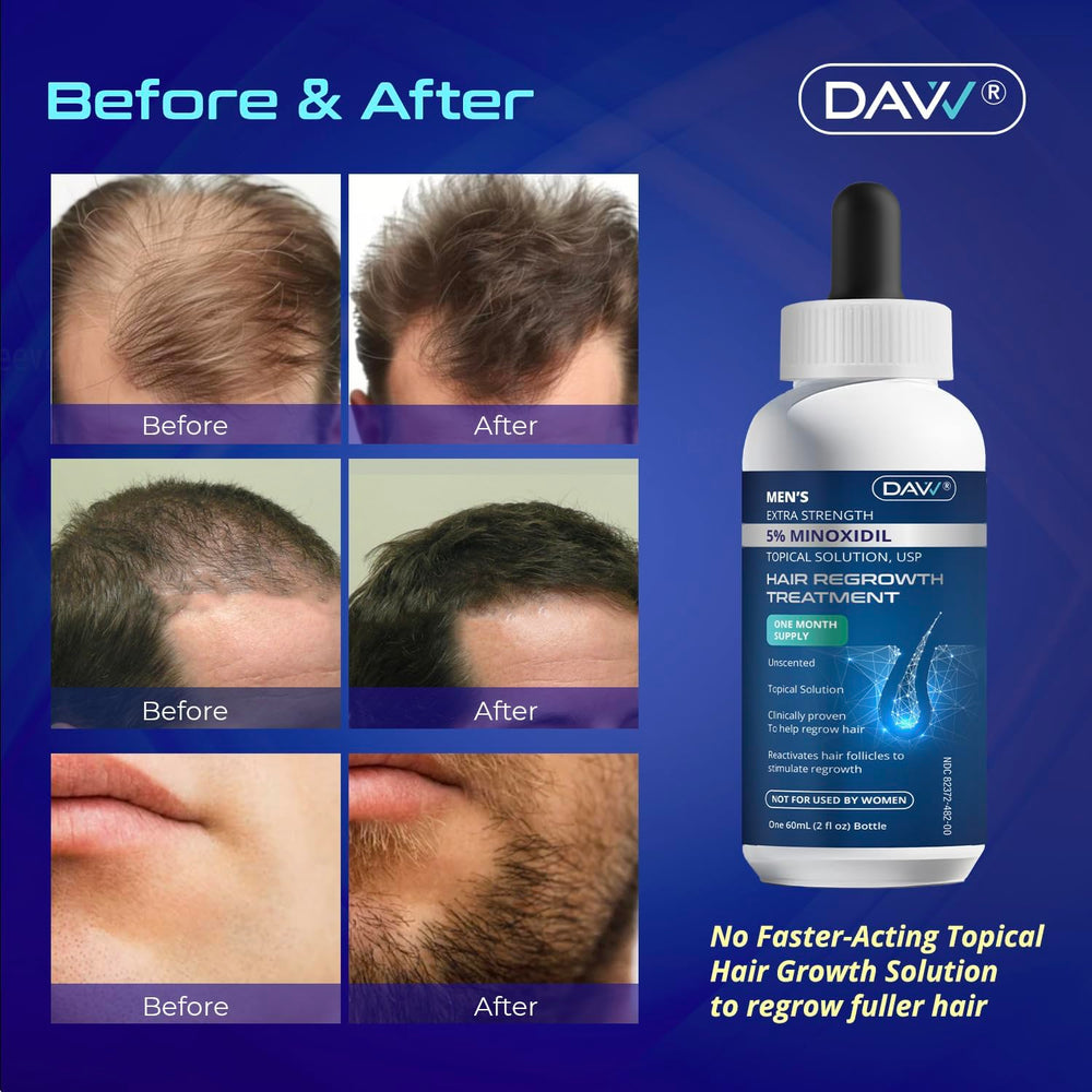 DAVV Biotin-enriched formula supports stronger hair from roots