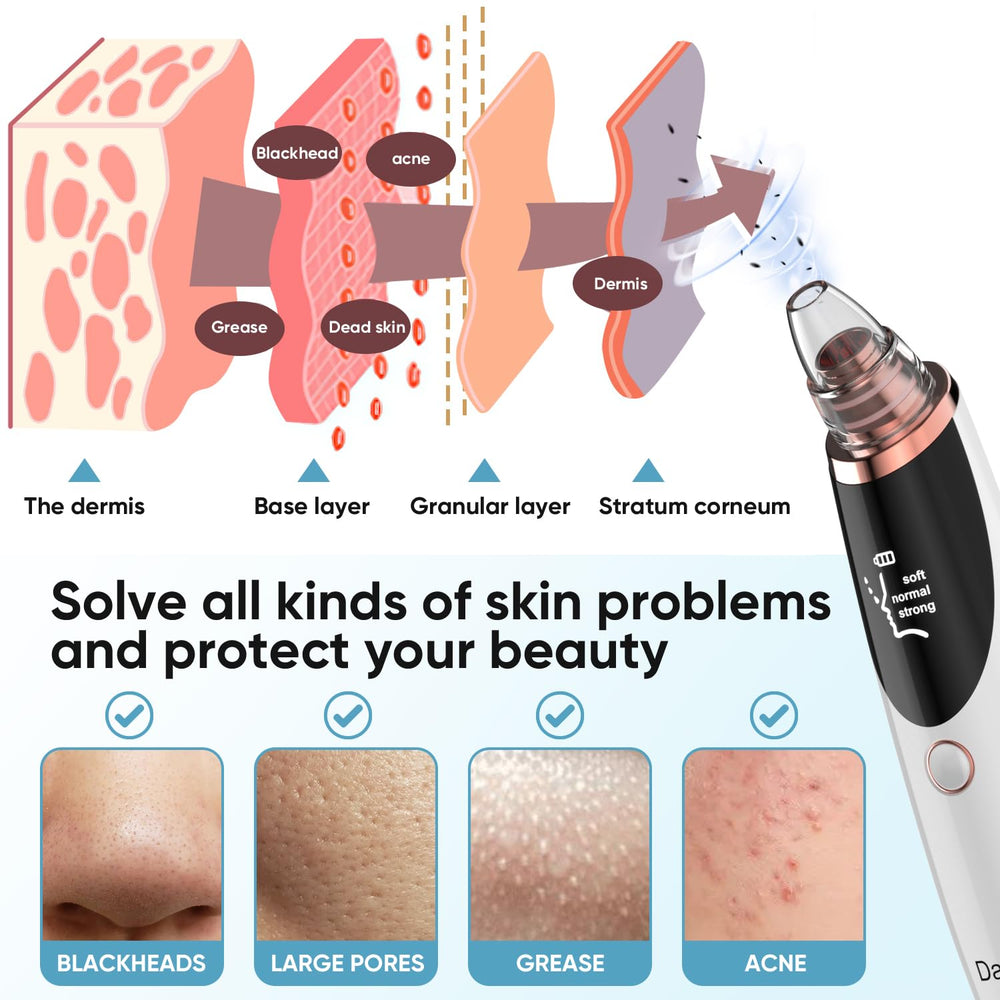 Daweir blackhead remover chamber view highlights visible collection of impurities.
