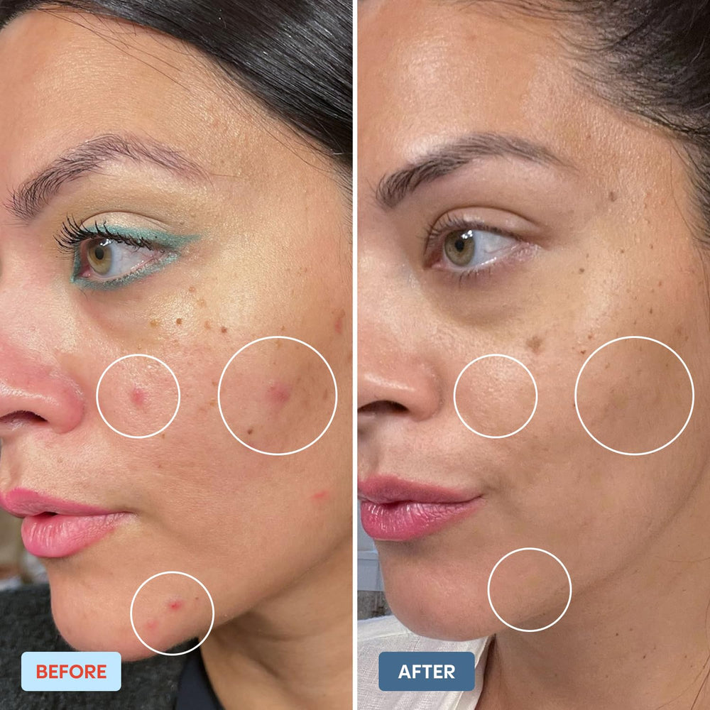 Daybreak Skincare Mighty Mist closeup-spray demonstrates precise application for calming skin