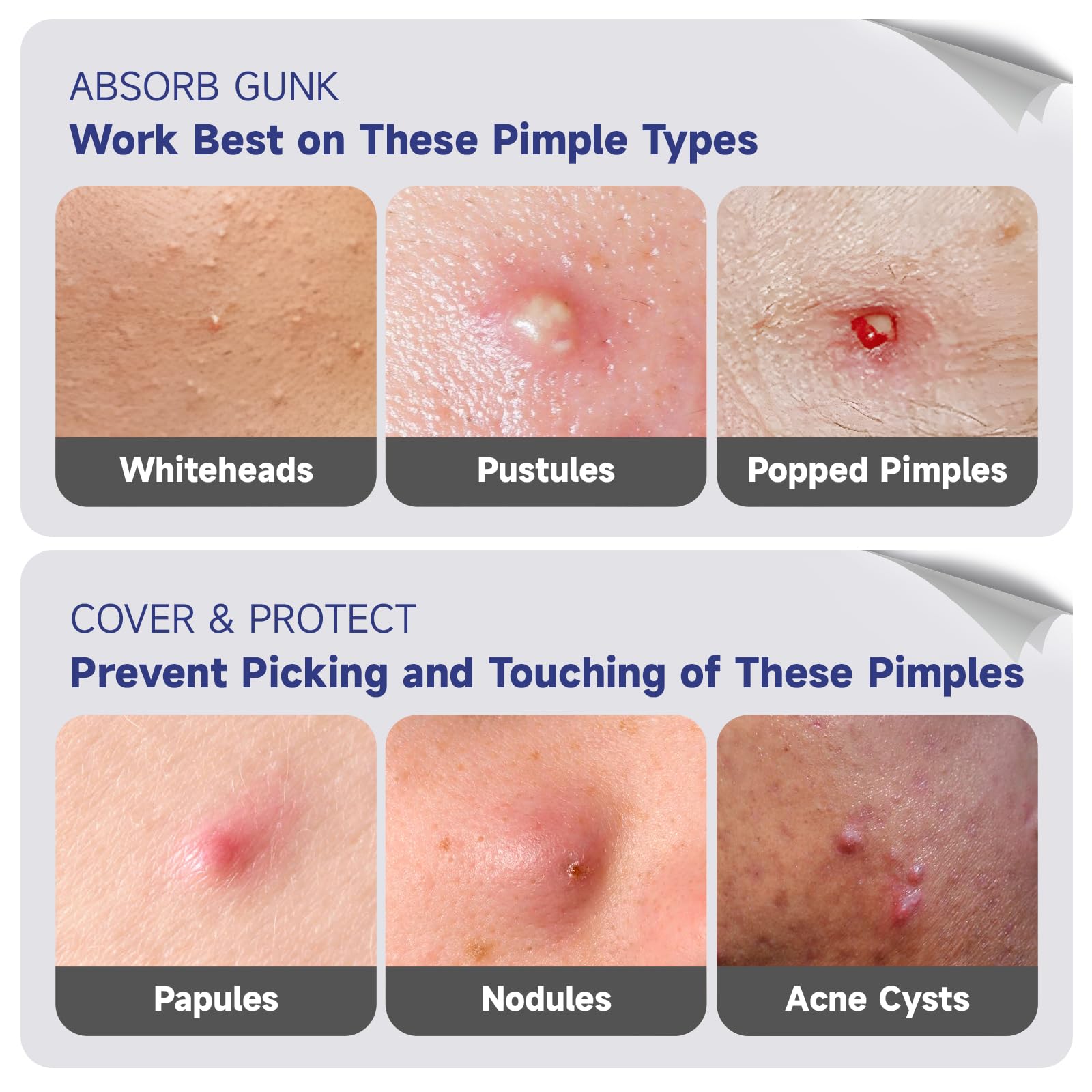 Dazzlook moon-shaped patch targets blemishes with hydrocolloid protection and soothing care.