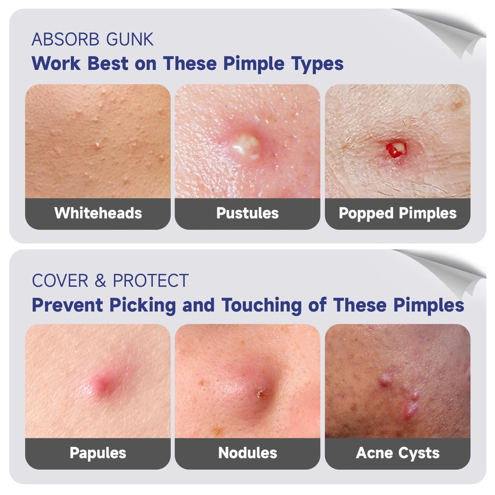 Dazzlook moon-shaped patch targets blemishes with hydrocolloid protection and soothing care.