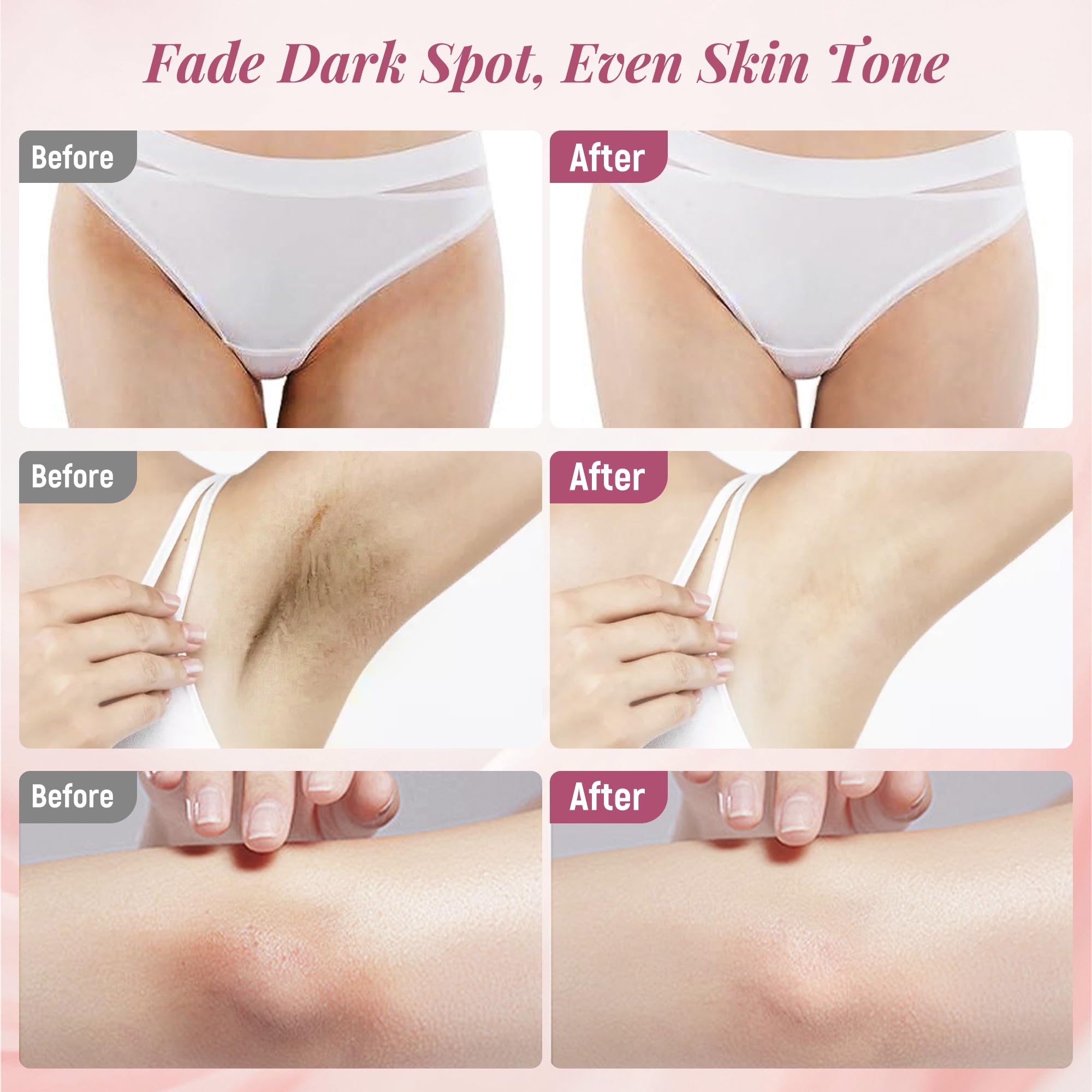 DCSCRK Skin Lightening Cream for inner thighs promoting even complexion.