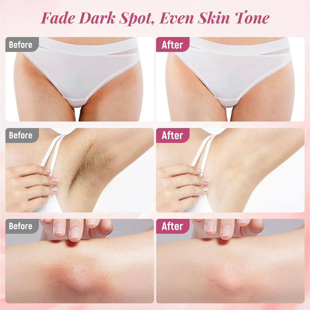 DCSCRK Skin Lightening Cream for inner thighs promoting even complexion.