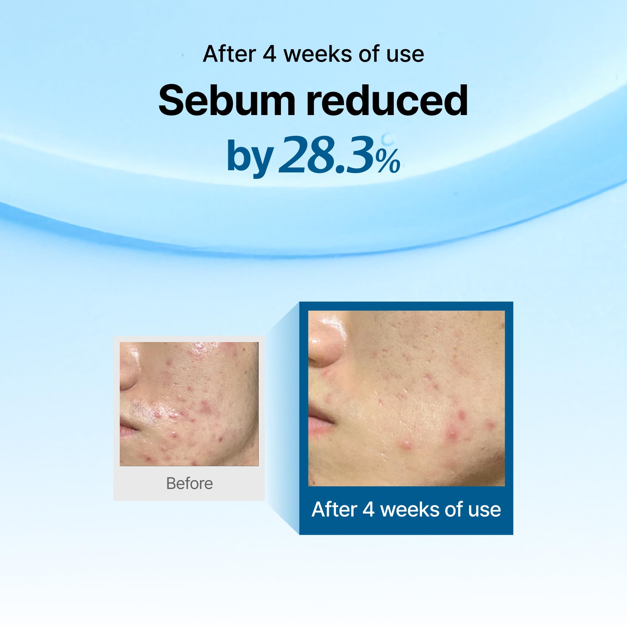DearKlairs Midnight Blue calm skin close-up illustrates redness relief and comfort.