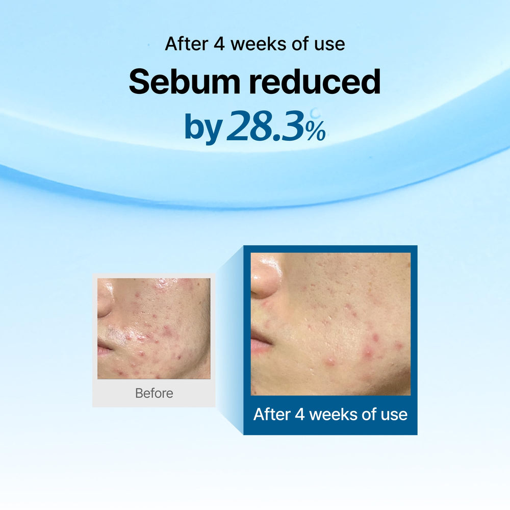 DearKlairs Midnight Blue calm skin close-up illustrates redness relief and comfort.