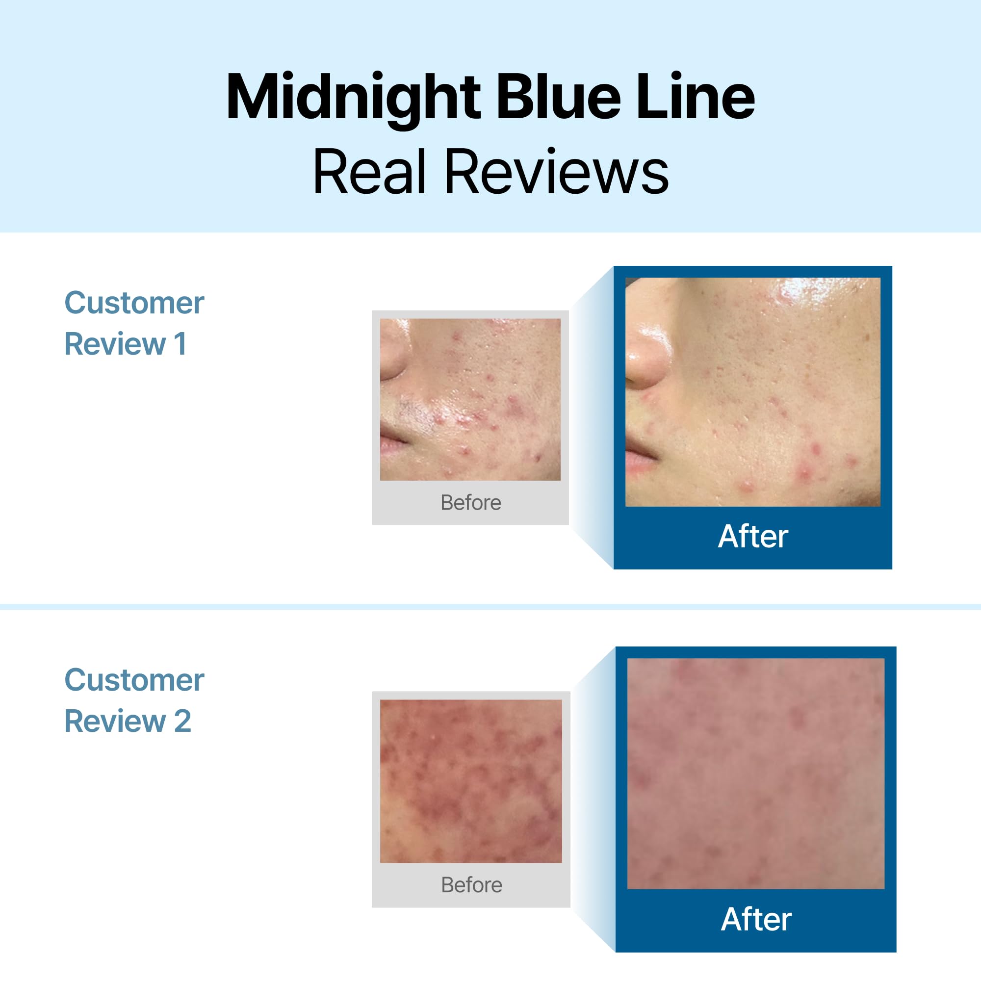 Blue hue cream swatch from DearKlairs signaling cooling soothing skincare routine