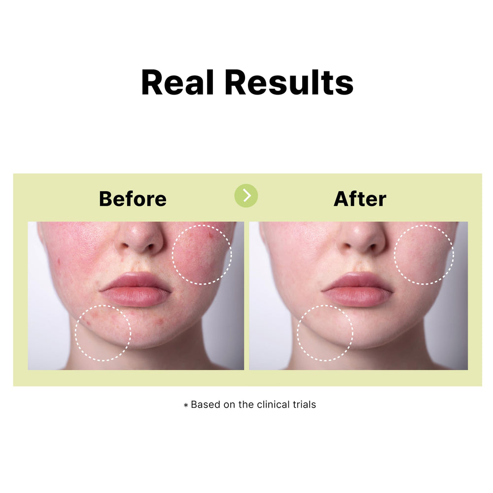 DearMYDEW niacinamide-salicylic acid blend close-up indicating clearer pores.