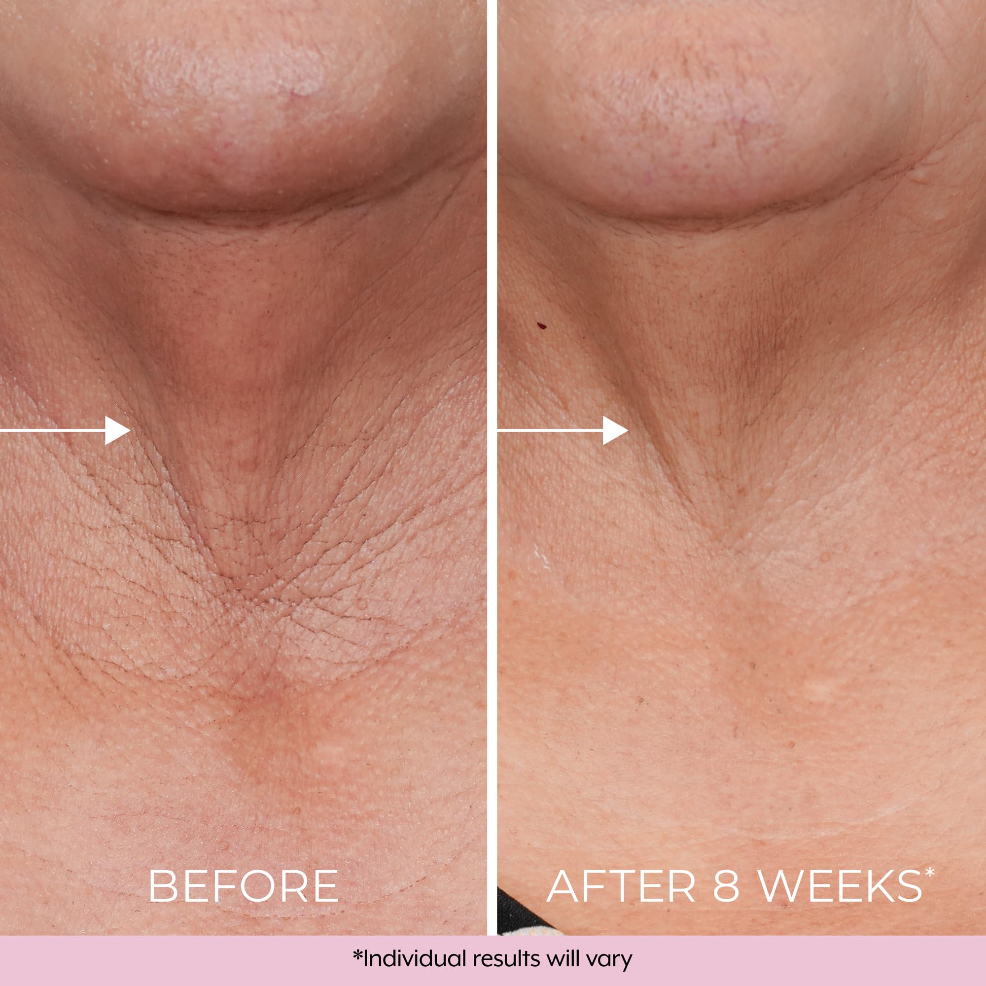 DEKLIDERM Neck Firming Cream swatch close-up for even tone and texture