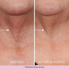 DEKLIDERM Neck Firming Cream swatch close-up for even tone and texture