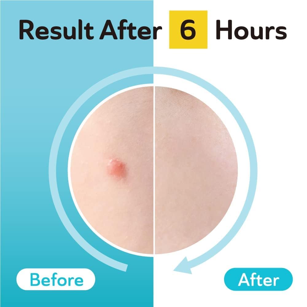 DERMA ANGEL 96-count pack details highlight value for daily use